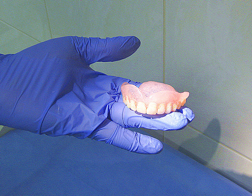 ПРОТЕЗУВАННЯ в стоматології «РЕСТОМА»: знімні конструкції