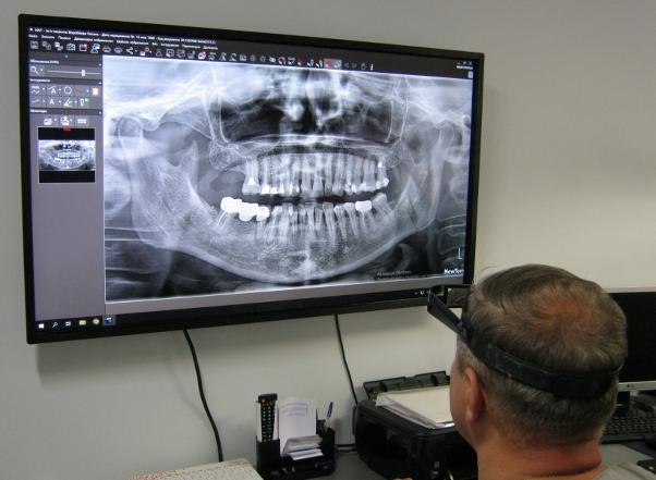 3D-сканування зубів – комп’ютерна томографія