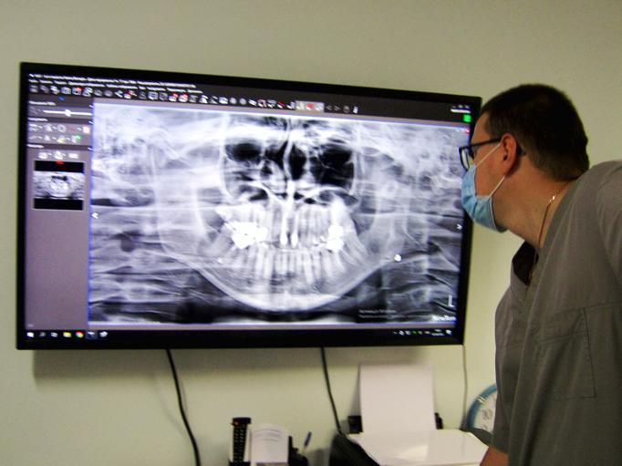 Ортопантомографія - панорамний 2D-знімок зубів показує загальний вигляд зубного ряду, щелеп, верхньощелепної пазух і скронево-нижньощелепних суглобів.